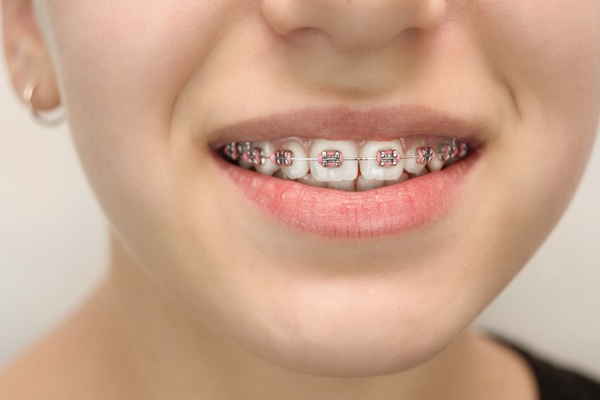 When Can A Child See A Braces Specialist?