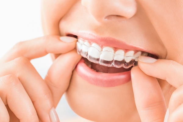 Can Invisalign Be Used for Top and Bottom Teeth? from Frisco Family Orthodontics in Frisco, TX