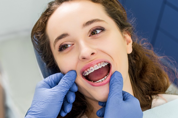 Tips From An Orthodontist On Caring For Your Teeth After Treatment